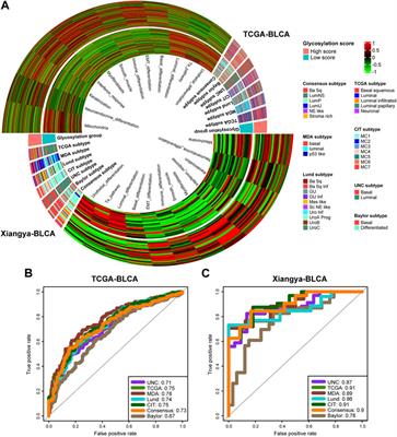 A glycosylation risk score comprehensively assists the treatment of bladder neoplasm in the real-world cohort, including the tumor microenvironment, molecular and clinical prognosis